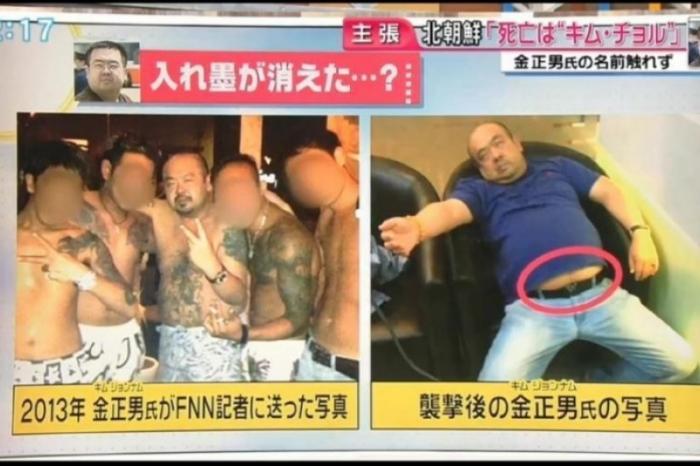 日媒称金正男腹部有纹身 质疑马来西亚调查结论