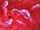 调查称7亿中国人感染幽门螺杆菌 78%的胃癌归因于它
